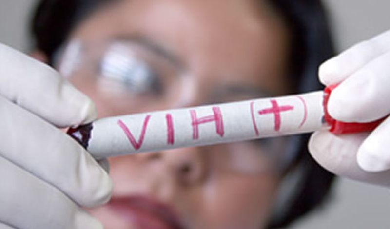 Jujuy: preocupación por el aumento de casos de jóvenes con sífilis y HIV en Alto Comedero