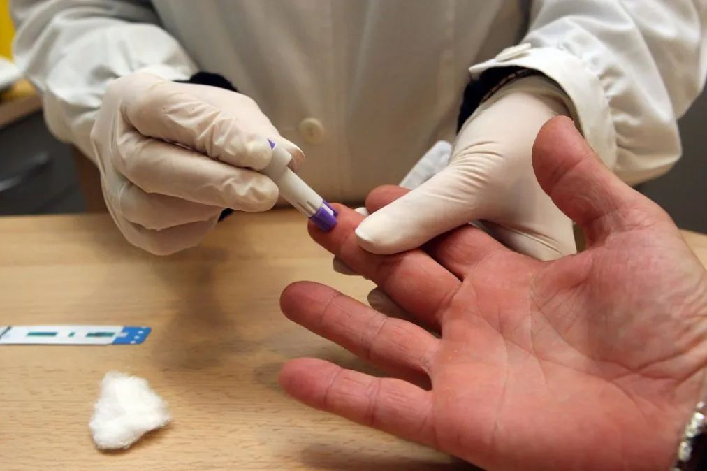 27 de junio – Día Nacional de la prueba de VIH