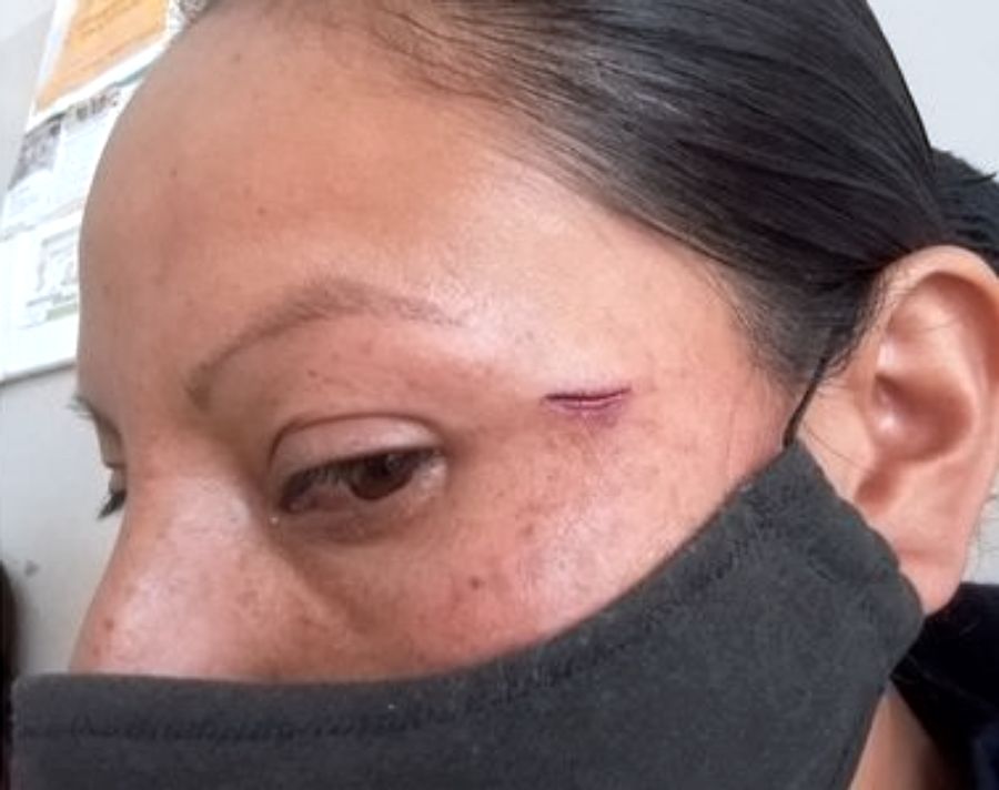 Jujuy: Una mujer trans que está detenida por homicidio atacó a una agente con un termo